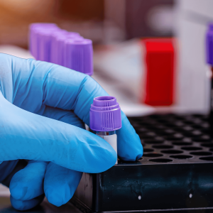 Hematologia e Doenças Imunomediadas 4ªedi