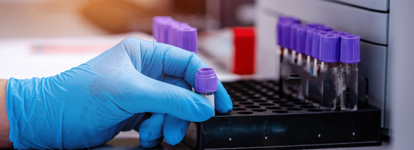 Hematologia e Doenças Imunomediadas 4ªedi
